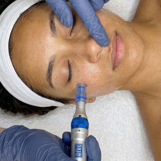 The Microinfusion Method™ with Topical Fillers Training + Product Kit